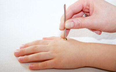 Shōnishin – japanische Kinderakupunktur